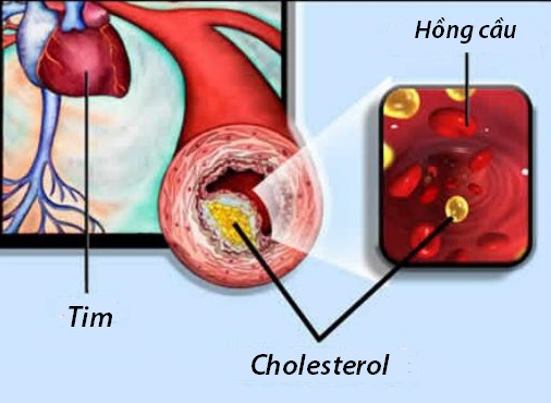 , Kiểm soát mỡ máu, chặn biến chứng tim mạch, Beurer Việt Nam